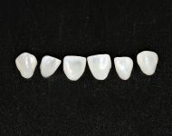 Kokie dantų protezai perkamiausi rinkoje?